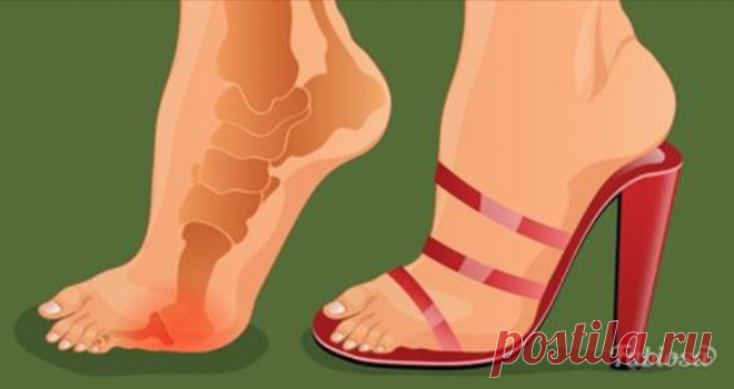 Каблуки в любом возрасте! Уловка, которая позволит избавиться от боли в ногах Пока человечество не придумает другую обувь, в которой женщина будет столь же сексуальной, как в туфлях с каблуком, прекрасная половина человечества будет и дальше страдать от опухших и стертых ног.Дл...
