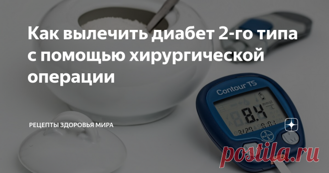 Как вылечить диабет 2-го типа с помощью хирургической операции Сахарный диабет 2-го типа — это распространенное заболевание, связанное с нарушением метаболизма. Характеризуется гипергликемией в хронической форме, которая развивается вследствие нарушения секреции инсулина и ухудшения его взаимодействия с клетками в тканях организма человека.  Инсулин, являясь гормоном поджелудочной железы, играет важнейшую роль в обмене веществ человеческого организма.
С его п