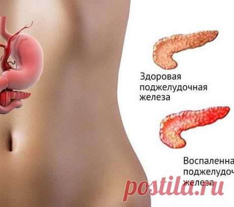 Если беспокоит поджелудочная железа.