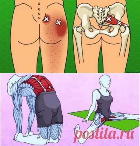 6 упражнений на растяжку, чтобы навсегда избавиться от боли в спине и бедрах » ЧапЧап