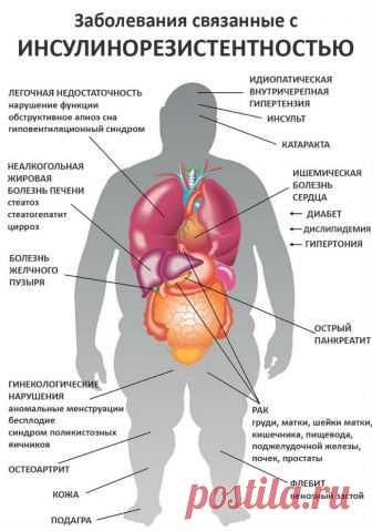 Как определить инсулинорезистентность, расчет индекса НОМА