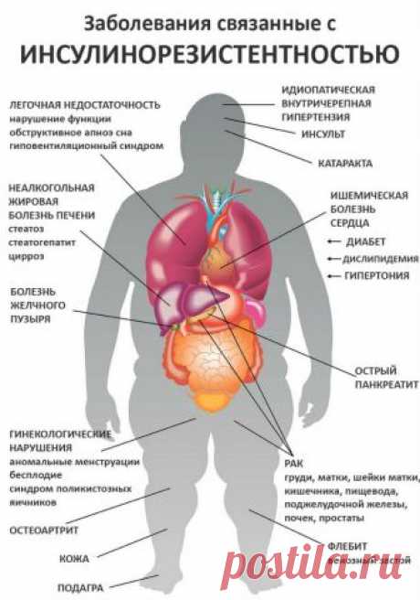 Как определить инсулинорезистентность, расчет индекса НОМА