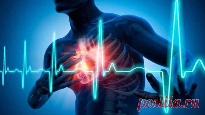Аритмия-ПОЛЕЗНЫЕ РЕЦЕПТЫ ДЛЯ СЕРДЦА.