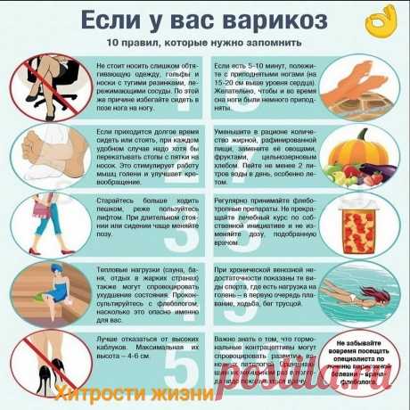 Варикоз-дело неприятное, однако от него довольно просто можно спастись, если следовать этим советам