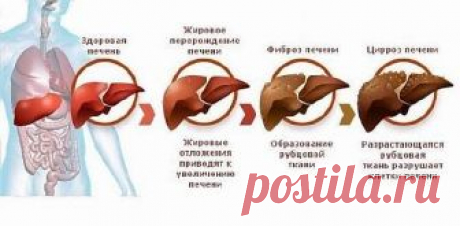 Как ухаживать за своей печенью   Печень совместно с желчными протоками и желчным пузырем — это своего рода перерабатывающий комбинат. Он не отдыхает даже ночью: очищает кровь от шлаков и собирает их в желчи. "Золотые" правила. …