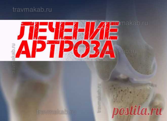 Лечение артроза (остеоартроза, ОА): таблетки, мази, уколы, тактика лечения, схемы лечения артроза | Врач травматолог-ортопед, онлайн кабинет