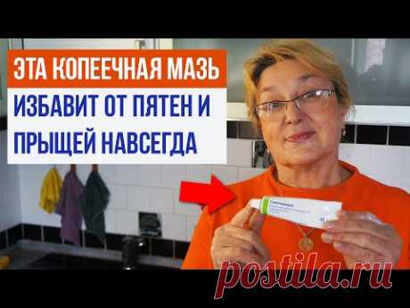 Копеечная мазь избавит от ПИГМЕНТАЦИИ и ПРЫЩЕЙ навсегда