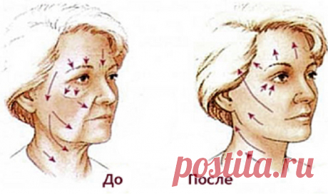 (47) Одноклассники