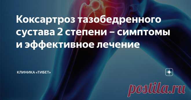 Коксартроз тазобедренного сустава 2 степени – симптомы и эффективное лечение Статья автора «Клиника «Тибет»» в Дзене ✍: Коксартроз 2 степени означает, что заболевание зашло уже далеко, и справиться с ним так просто уже не получится.