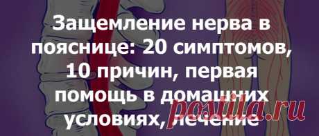 Защемление нерва в пояснице: симптомы, причины, первая помощь, упражнения, что делать в домашних условиях, лечение
