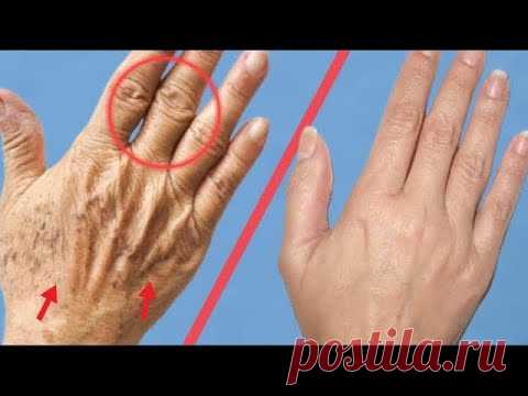 Как сделать Ваши Руки Моложе На 5 Лет | Удалить Пигментные Пятна С Ваших Рук