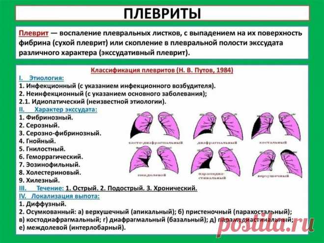 жидкость в плевре легких причины и лечение: 2 тыс изображений найдено в Яндекс Картинках