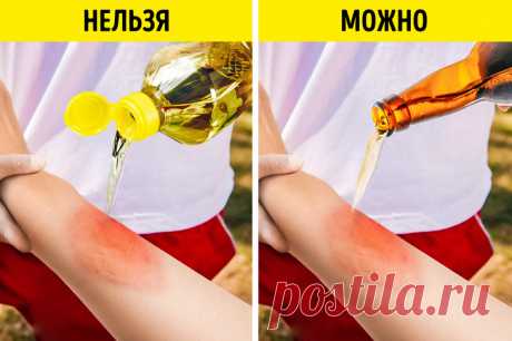 10 подручных средств, которые отлично подойдут для оказания первой помощи