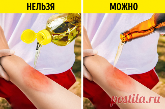 10 подручных средств, которые отлично подойдут для оказания первой помощи