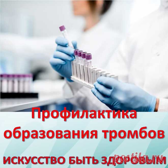 Профилактика образования тромбов.
Инфаркт, инсульт, тромбофлебит, варикозное расширение вен, геморрой… Что общего у всех этих заболеваний?
Одна из причин их возникновения — густая кровь. Она не может свободно продвигаться по кровеносным сосудам (особенно по сосудам мозга) и транспортировать питательные вещества и кислород. Замедленный кровоток также приводит к кислородному голоданию внутренних органов.
Некоторые знают, что густую кровь надо разжижать. Но многие
и не догадываются, что можно
