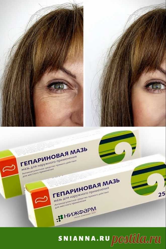 Гепариновая мазь для лица. Свежее и подтянутое лицо уже через пару дней. ➡️ Кликайте на фото, чтобы прочитать полностью