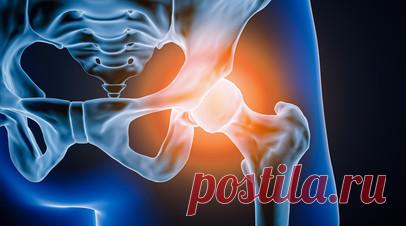 Врач Загайнов предупредил об опасных последствиях перелома шейки бедра. Травматолог-ортопед сети «СМ-Клиника» Андрей Загайнов рассказал, что перелом шейки бедра в пожилом возрасте часто связан с сопутствующим заболеванием — остеопорозом, который характеризуется снижением прочности костей. Читать далее