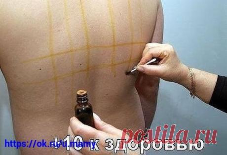 ЦЕЛЕБНЫЕ СВОЙСТВА ЙОДОВОЙ СЕТКИ!!! ------------------------------------------------------------------------------------------- Чтобы не потерять рецепт, жмите класс, а потом поделиться. ------------------------------------------------------------------------------------------- Можно насчитать не менее двадцати различных заболеваний, при которых облегчить состояние человека можно путем наложения йодовой сетки. Крошечная склянка с йодом обычно имеется в каждой домашней аптечке, ведь никто в повсед