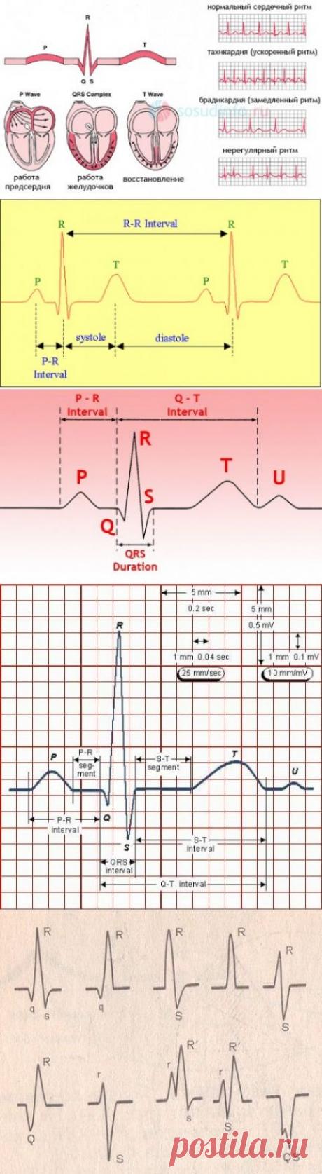 ЭКГ Наше здоровье Будьте здоровы вместе с нами