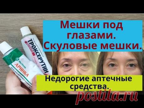 Мешки под глазами, малярные мешки, отеки глаз. Бюджетные аптечные средства от мешков под глазами.