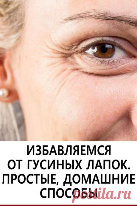 Избавляемся от «гусиных лапок»! «Гусиные лапки» - Это морщинки в уголках глазах. Они появляются с возрастом, когда кожа теряет коллаген и гиалуроновую кислоту.