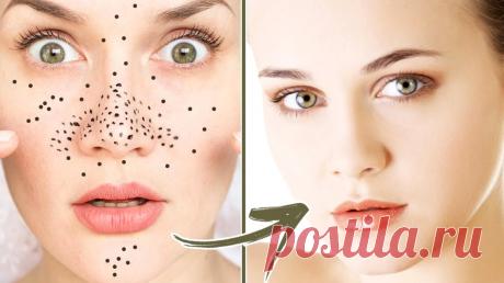 Как избавиться от черных точек на лице &amp;raquo; Женский Мир
