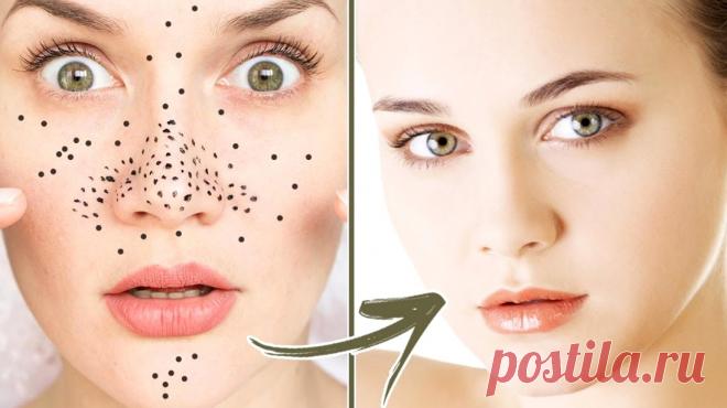 Как избавиться от черных точек на лице &raquo; Женский Мир