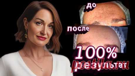 Показываю, КАК быстро убрать застарелую пигментацию и возрастные поры. 100% результат. | Алла Ганова | Дзен