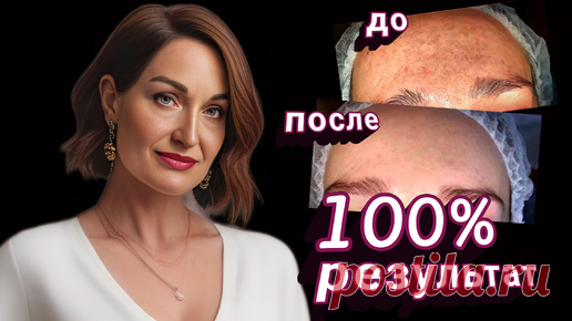 Показываю, КАК быстро убрать застарелую пигментацию и возрастные поры. 100% результат. | Алла Ганова | Дзен