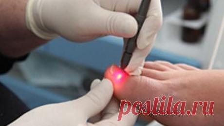 Лечение грибка ногтя запущенная форма: быстро и эффективно

Грибок ногтей получить в настоящее время очень легко. ... Чем лечить запущенную форму грибка ногтя? Начиная лечение грибка ногтя в запущенной стадии следует помнить о длительном устранении ... Чем лечить грибок ногтей на ногах? Отзывы!