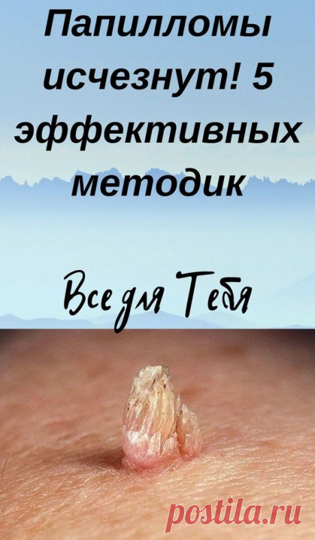 Папилломы исчезнут! 5 эффективных методик