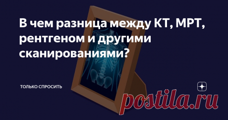 В чем разница между КТ, МРТ, рентгеном и другими сканированиями? Раньше внутренние органы человека мог увидеть только хирург в процессе операции. Сейчас в арсенале врачей сразу несколько способов проверить внутренности пациента без скальпеля. Но это не мешает нам бояться их — из-за потенциального облучения, высокой стоимости или простого непонимания.
Объясняем, какие есть сканирования, зачем они нужны и когда их применение оправдано.
Самый старый из известных