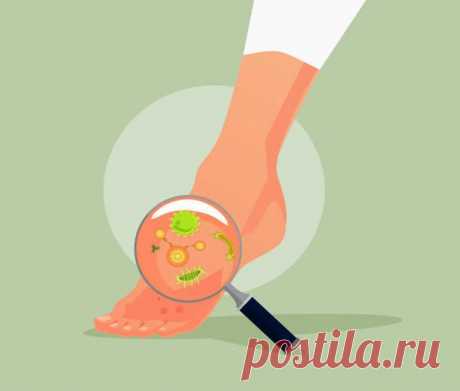 Грибок ногтей: Как победить при помощи уксуса и пищевой соды? Пищевая сода, как и яблочный уксус, обладают противогрибковыми свойствами, поэтому они помогут справится с таким неприятным явлением, как грибковое поражение ногтей. Главное действовать строго по инст...