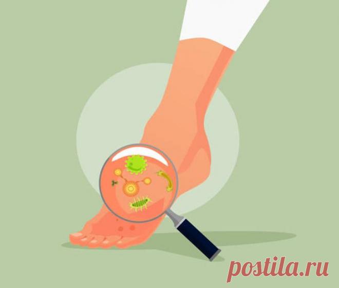 Грибок ногтей: Как победить при помощи уксуса и пищевой соды? Пищевая сода, как и яблочный уксус, обладают противогрибковыми свойствами, поэтому они помогут справится с таким неприятным явлением, как грибковое поражение ногтей. Главное действовать строго по инст...