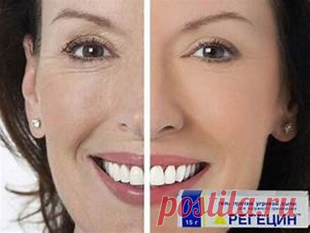 СЕНСАЦИЯ! Регецин – лучшее средство от мимических морщин и мешков под глазами!