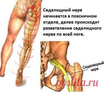 Лечение седалищного нерва. 11 рецептов народной медицины