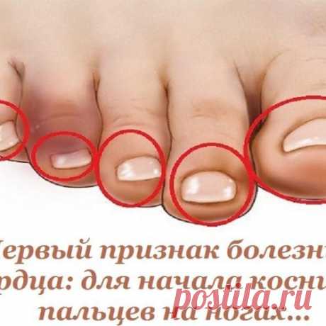 Первый признак болезни сердца: для начала коснись пальцев на ногах...