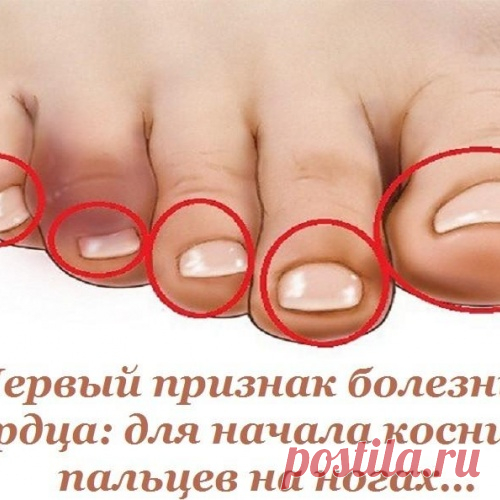 Первый признак болезни сердца: для начала коснись пальцев на ногах...