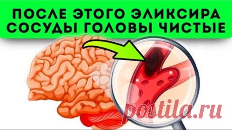 Выбросил таблетки в мусор! Копеечное средство + советы врачей, сделали сосуды головы чистыми