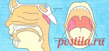 «ПОЗА ЛЬВА» — УПРАЖНЕНИЕ ДЛЯ ОЧИЩЕНИЯ МИНДАЛИН.