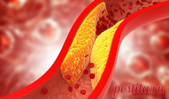 Избавиться от высокого холестерина без медикаментов Холестерин играет жизненно важную роль в поддержании нормальной работы организма, однако его избыток может стать причиной серьёзных заболеваний. Важно понимать, что холестерин — это липид,...