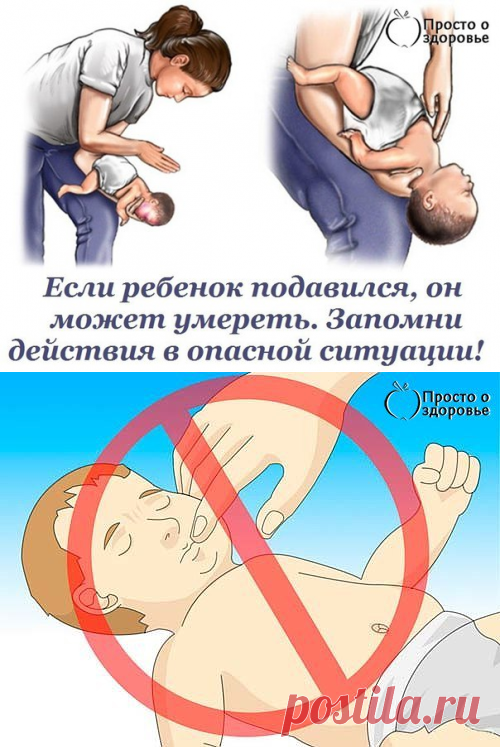 Если ребенок подавился, он может умереть. Запомни действия в опасной ситуации!