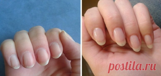 Как быстро отрастить ногти, которые никогда не сломаются - Советы и Рецепты