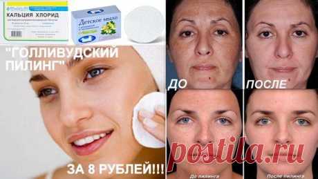 Пилинг.