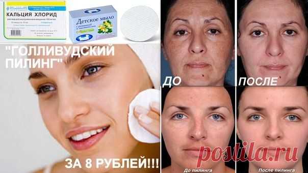 Пилинг.