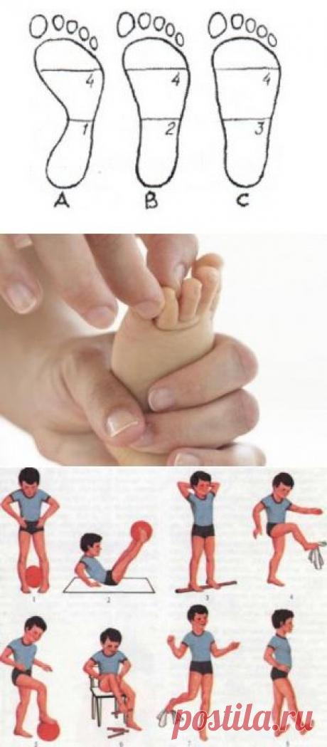 Плоскостопие у ребенка: причины, последствия, способы лечения. Массаж и гимнастика при плоскостопии