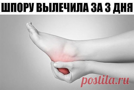 ШПОРУ ВЫЛЕЧИЛА ЗА 3 ДНЯ
Поделюсь рецептами от пяточных шпор. Прошлым летом на юге после ванн у меня так разболелась нога, что я не знала, куда ее деть. Пятка горела огнем. Приехав домой, побежала к хирургу. Молодая врач сделала снимок и объявила, что у меня после ванн обострилась пяточная шпора. Дала мне какую-то «памятку» - и все. Я поняла, что надо самой лечиться. Обратилась к народной медицине - стала искать рецепты от шпор. Все, что нашла, выписала и посылаю вам. Ведь сколько еще таких как