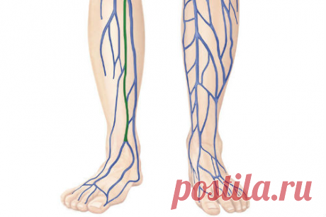 Застой лимфы в ногах: причины и лечение