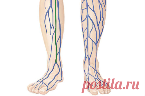 Застой лимфы в ногах: причины и лечение