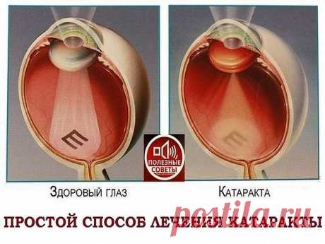 (73) Одноклассники